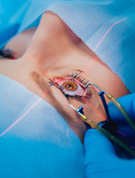 Laser,Vision,Correction.,A,Patient,And,Team,Of,Surgeons,In Laser,Vision,Correction.,A,Patient,And,Team,Of,Surgeons,In